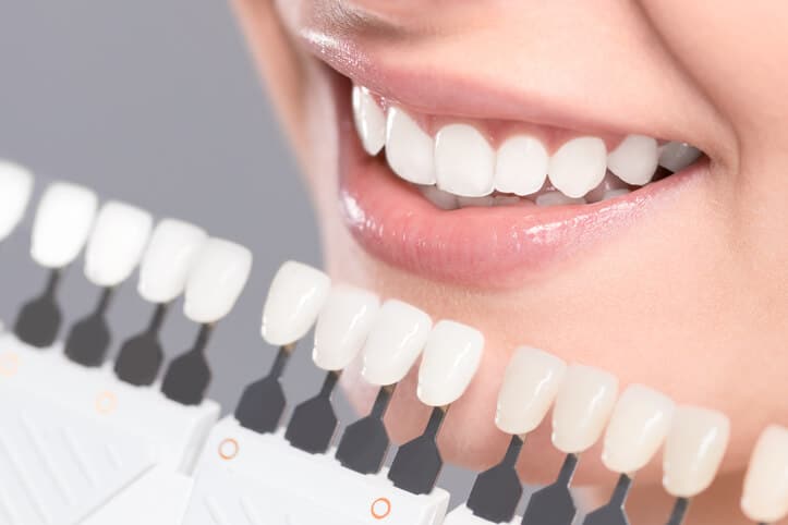types of dental implants systems