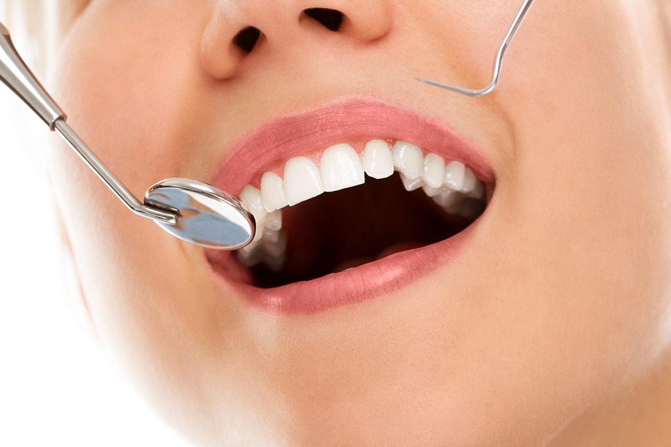 A woman is smiling for composite bonding teeth while being at the dentist