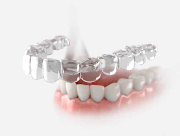 cleaning Invisalign retainers