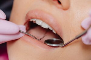 cosmetic dentistry treatments