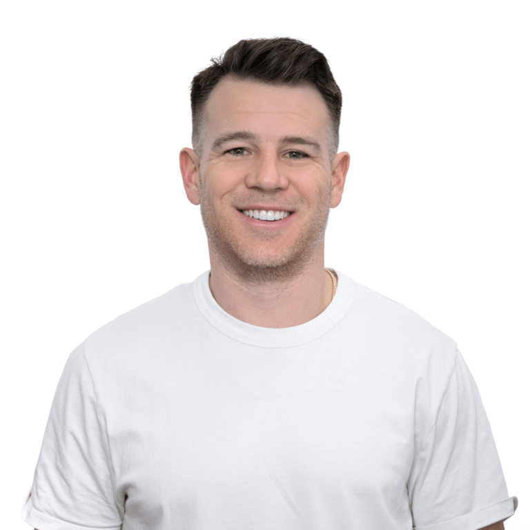 smile makeover veneers before and after